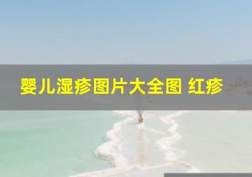 婴儿湿疹图片大全图 红疹